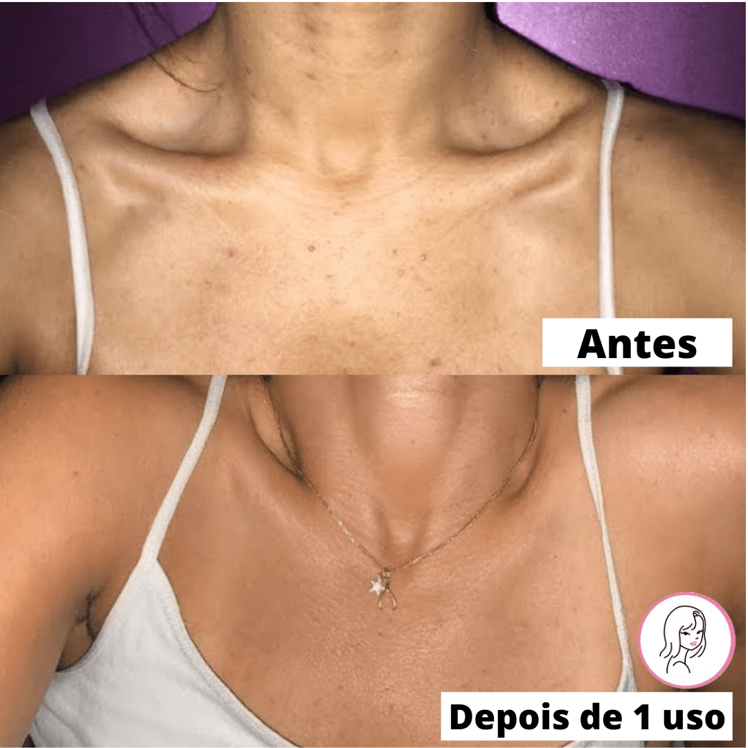 Luvas Esfoliantes de Banho SkinSoft